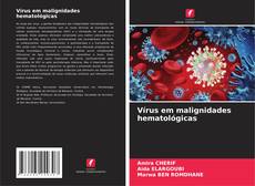 Copertina di Vírus em malignidades hematológicas