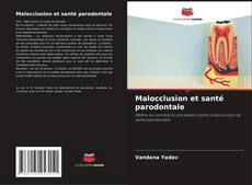 Bookcover of Malocclusion et santé parodontale