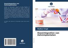 Oseointegration von Zahnimplantaten kitap kapağı