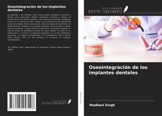 Buchcover von Oseointegración de los implantes dentales