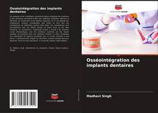 Bookcover of Osséointégration des implants dentaires