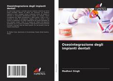 Capa do livro de Oseointegrazione degli impianti dentali 