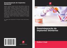 Oseointegração de Implantes Dentários的封面