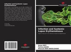 Copertina di Infection and Systemic Lupus Erythematosus