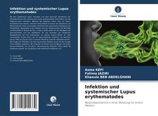 Buchcover von Infektion und systemischer Lupus erythematodes