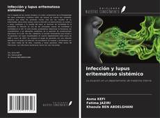 Buchcover von Infección y lupus eritematoso sistémico