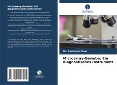 Capa do livro de Microarray-Gewebe: Ein diagnostisches Instrument 
