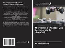 Bookcover of Microarray de tejidos: Una herramienta de diagnóstico