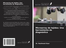 Capa do livro de Microarray de tejidos: Una herramienta de diagnóstico 