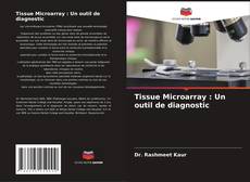 Copertina di Tissue Microarray : Un outil de diagnostic