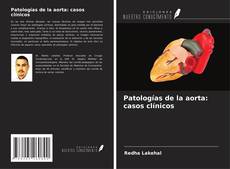 Patologías de la aorta: casos clínicos kitap kapağı