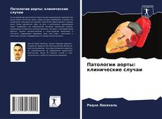 Bookcover of Патологии аорты: клинические случаи