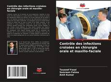 Buchcover von Contrôle des infections croisées en chirurgie orale et maxillo-faciale