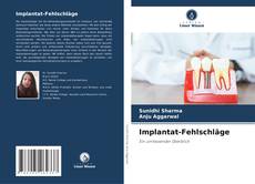 Portada del libro de Implantat-Fehlschläge