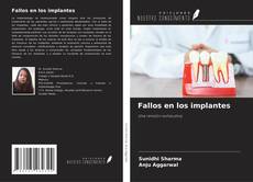 Fallos en los implantes的封面