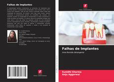Bookcover of Falhas de Implantes