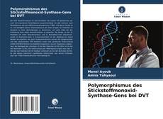 Polymorphismus des Stickstoffmonoxid-Synthase-Gens bei DVT kitap kapağı