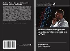 Polimorfismo del gen de la óxido nítrico sintasa en la TVP的封面