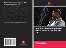 Bookcover of Polimorfismo do gene do óxido nítrico sintase em DVT