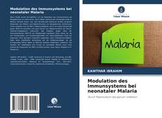 Couverture de Modulation des Immunsystems bei neonataler Malaria
