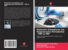 Bookcover of Materiais Exemplares em Regeneração Periodontal - PRP & PRF