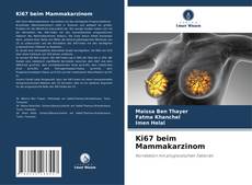 Bookcover of Ki67 beim Mammakarzinom