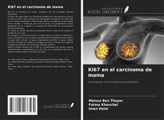 Bookcover of Ki67 en el carcinoma de mama