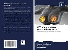 Portada del libro de Ki67 в карциноме молочной железы