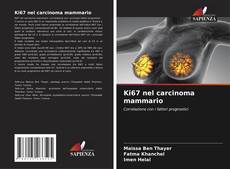 Portada del libro de Ki67 nel carcinoma mammario
