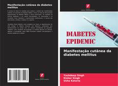 Capa do livro de Manifestação cutânea da diabetes mellitus 