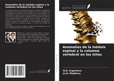 Borítókép a  Anomalías de la médula espinal y la columna vertebral en los niños - hoz