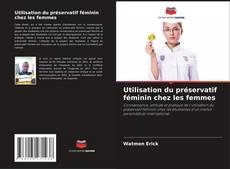 Copertina di Utilisation du préservatif féminin chez les femmes