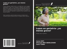 Обложка Lupus en geriatría: ¿es menos grave?