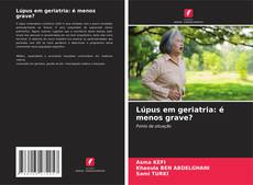 Bookcover of Lúpus em geriatria: é menos grave?