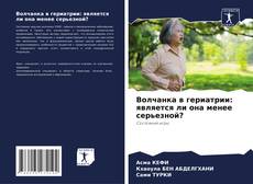 Bookcover of Волчанка в гериатрии: является ли она менее серьезной?