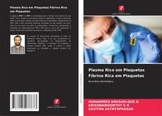 Bookcover of Plasma Rico em Plaquetas Fibrina Rica em Plaquetas
