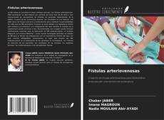 Copertina di Fístulas arteriovenosas