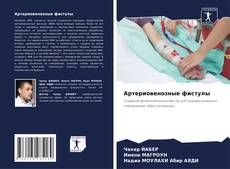 Capa do livro de Артериовенозные фистулы 