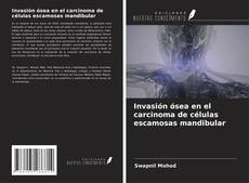 Invasión ósea en el carcinoma de células escamosas mandibular的封面