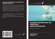 Copertina di AYUDAS RETENTIVAS EN PRÓTESIS MAXILOFACIALES