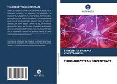 Bookcover of THROMBOZYTENKONZENTRATE