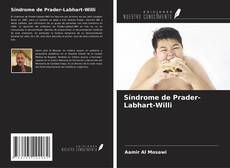 Copertina di Síndrome de Prader-Labhart-Willi
