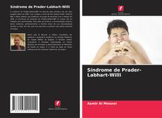 Capa do livro de Síndrome de Prader-Labhart-Willi 