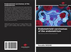 Buchcover von Endometrioid carcinomas of the endometrium