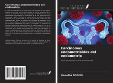 Bookcover of Carcinomas endometrioides del endometrio