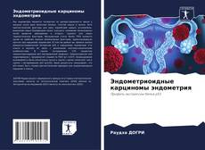 Buchcover von Эндометриоидные карциномы эндометрия