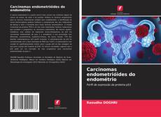 Borítókép a  Carcinomas endometrióides do endométrio - hoz