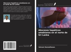 Buchcover von Abscesos hepáticos amebianos en el norte de Sri Lanka