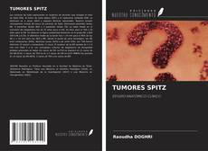 Bookcover of TUMORES SPITZ
