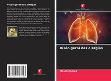 Capa do livro de Visão geral das alergias 